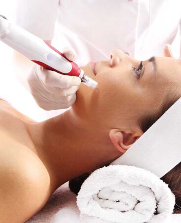 microneedling-leistung