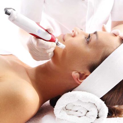 microneedling-leistung