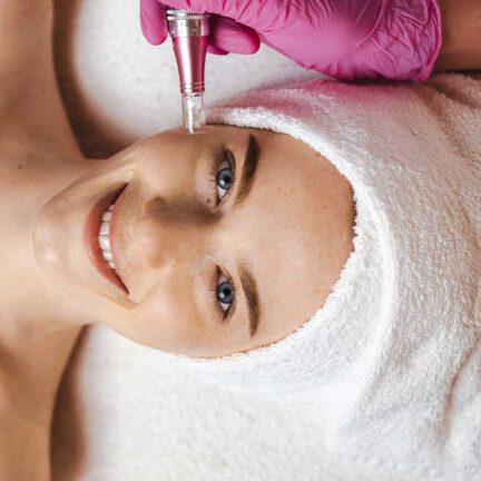 rf-microneedling